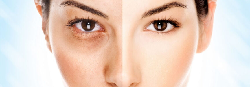 img_microdermobrasao